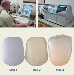 cad cam dental lab